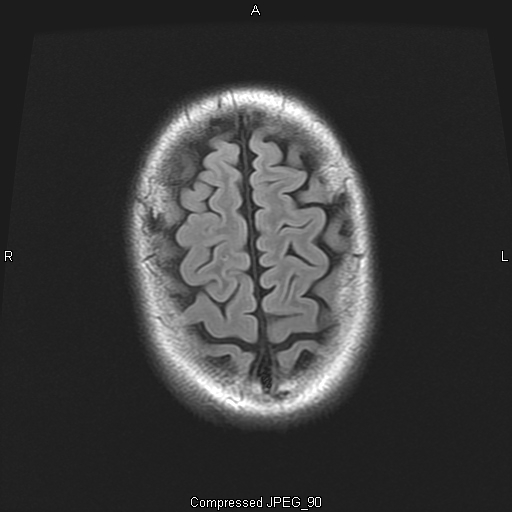 MRI Album 4 Pic 31
